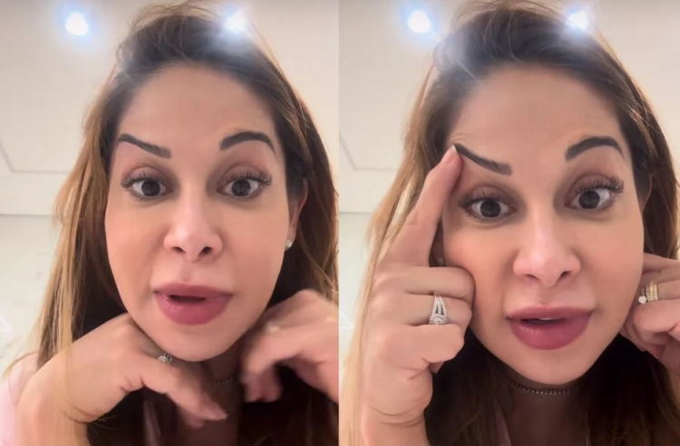 “Maíra Cardi revela resultado desastroso de procedimento estético: ‘Que trapalhada!'”