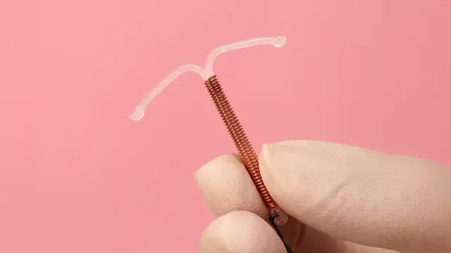 Cobertura de DIU hormonal para endometriose é garantida por planos de saúde