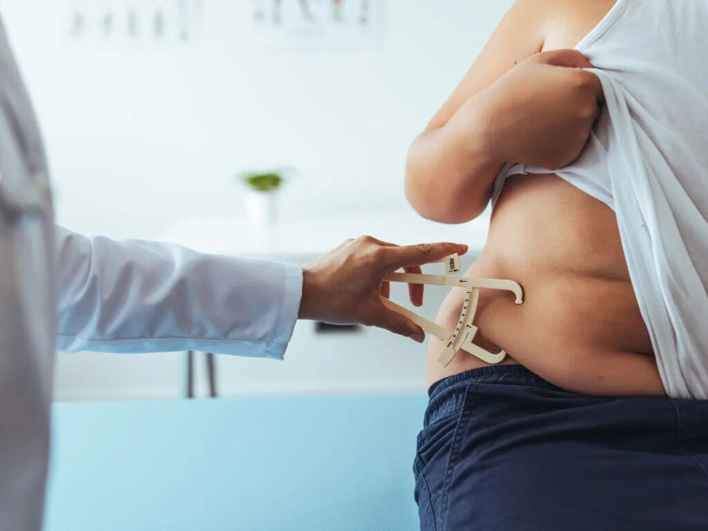Crescimento alarmante da obesidade infantil desde 1990 leva OMS a lançar novo guia de tratamento